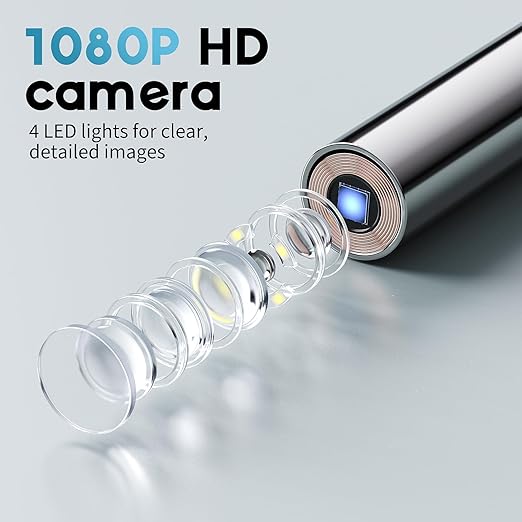 Viora's Otoscope Ear Camera