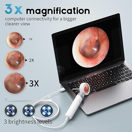 Viora's Otoscope Ear Camera
