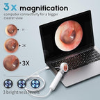 Viora's Otoscope Ear Camera